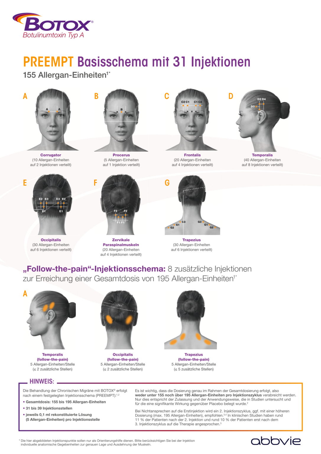 Botox zur Behandlung der chronischen Migräne - ORTHO | MOVE